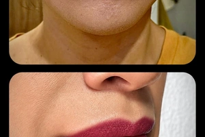 Cosmetic Tattooing - Image 1