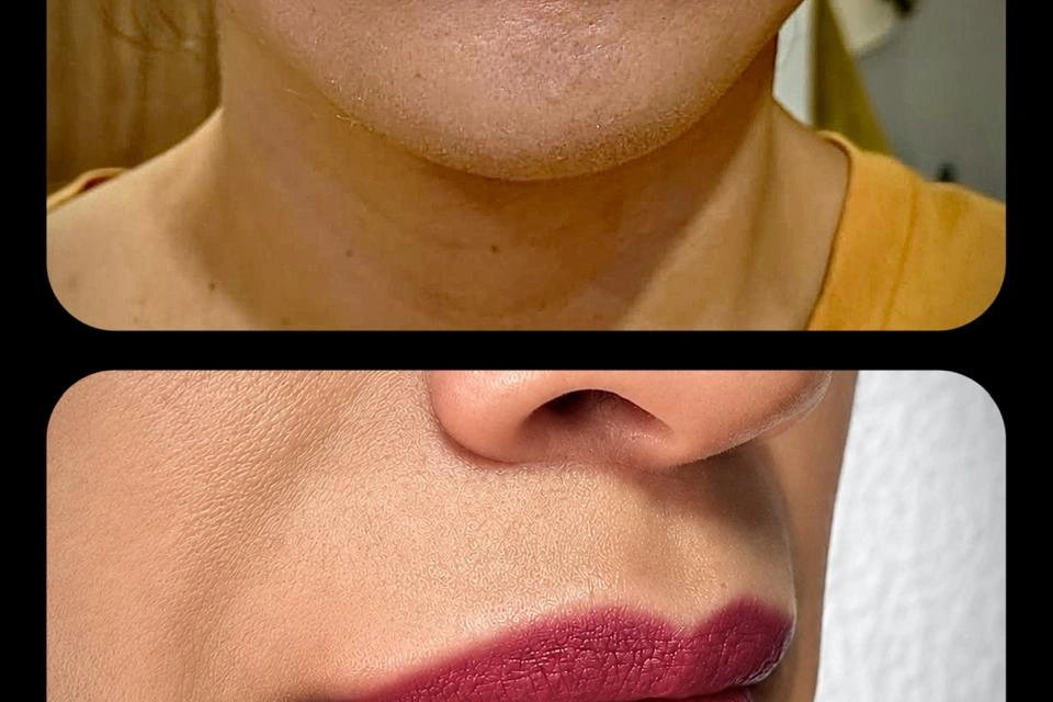 Cosmetic Tattooing
