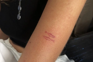 Stich - Image 7
